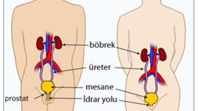 BÖBREK KİSTİ