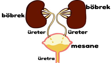 Üreter Kanserleri